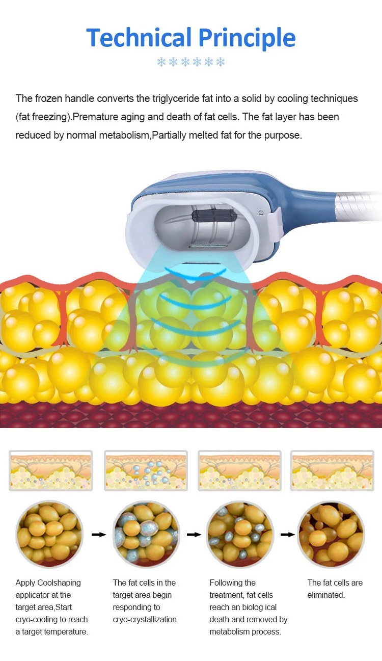 0cc75c86-928f-49b6-9338-17c00a64bb4e