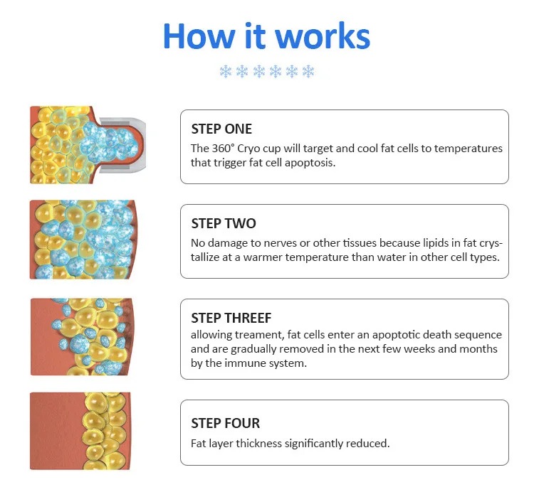 35ed62ff-8ff9-45ea-84b3-98f5ec2cf89d